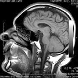 A) Presenta una imagen de un cerebro tomada con TC.