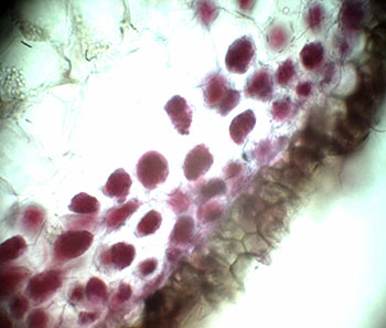 Corte transversal en raíz de orquídea con presencia de hongo micorríztico 50 aumentos