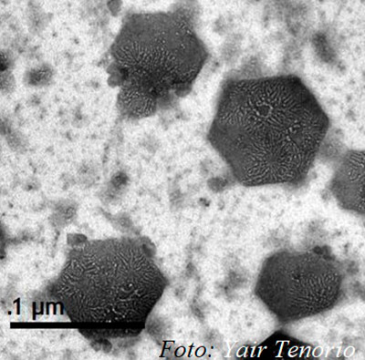 Partículas biopoliméricas observadas por microscopia electrónica de transmisión. Foto: Yair Tenorio
